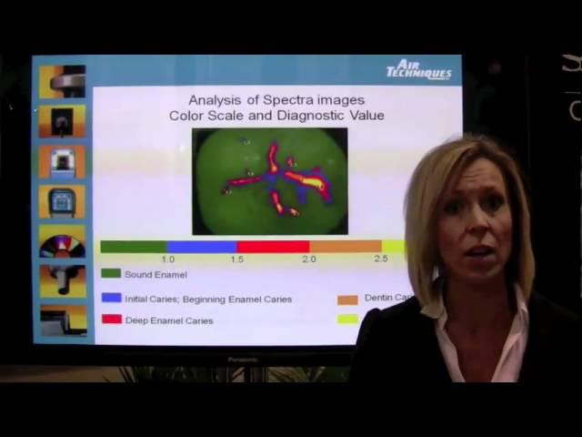 Anastasia Turchetta, RDH, discusses the Spectra caries detection system-full version