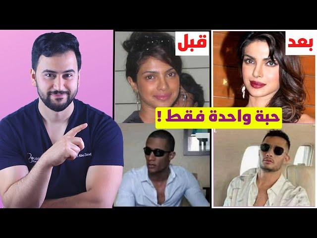 كشف المستور .. سر بياض بشرة المشاهير