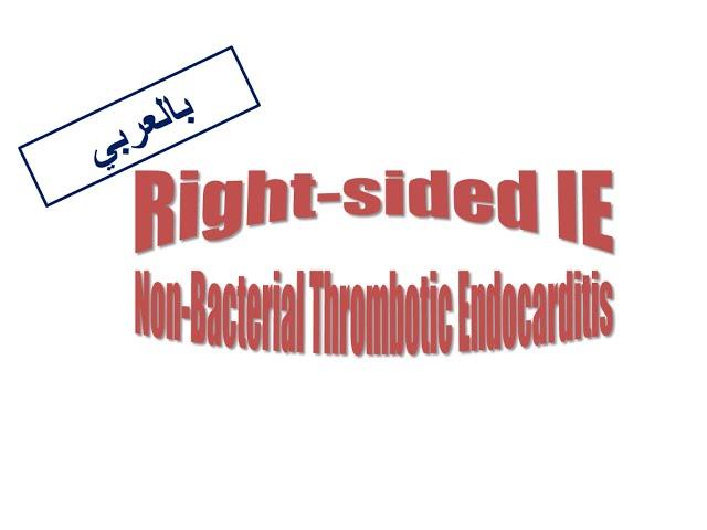 5. Right-sided IE & NBTE (Arabic Version)