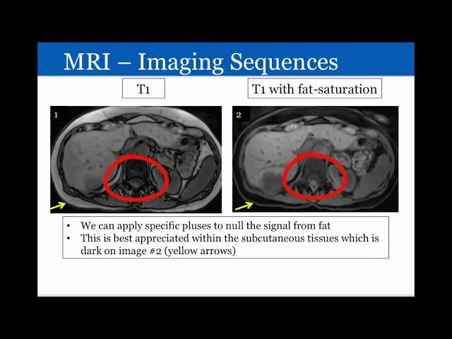 Introduction to Radiology: Magnetic Resonance Imaging