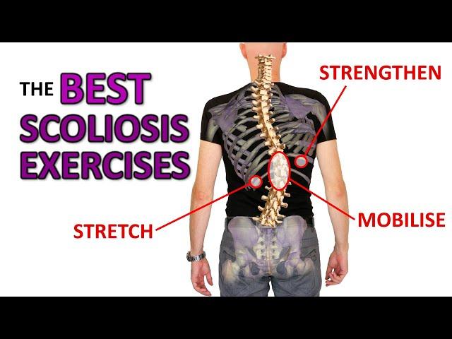 THE Best Exercises For Scoliosis