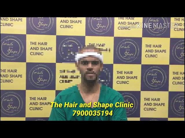 Hair transplant Patient Review -  4