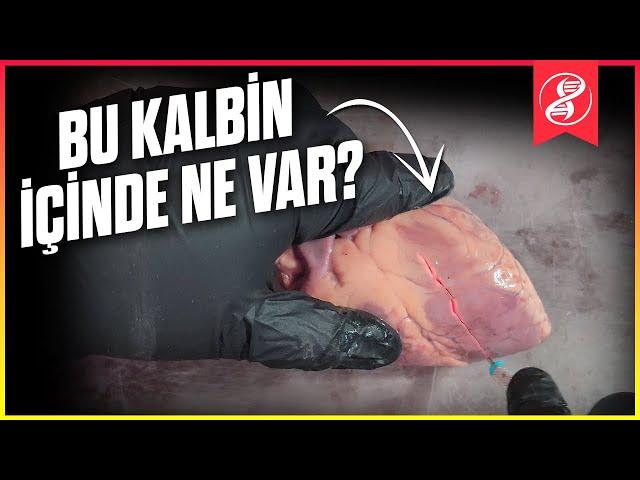 Kalbin İçinde Ne Var? Açıp Bakalım!