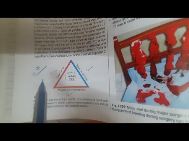 Hemorrhage....General Surgery