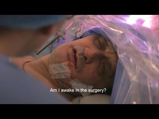 Peter is having awake open brain surgery | Scotland's Superhospital