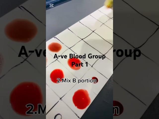 A-ve Part 1 how to easy and simple method #bloodgroup @Lablearning10 @Pathalogy10 #laboratory