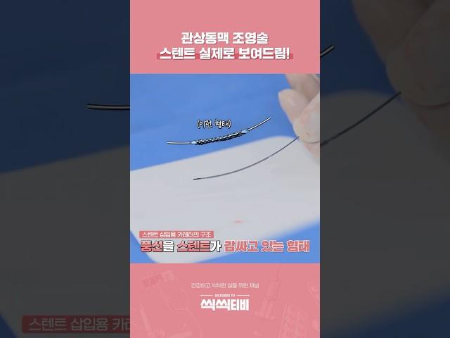 관상동맥 조영술(CAG), 스텐트 실제로 보여드림! #관상동맥 질환 #조정래 교수