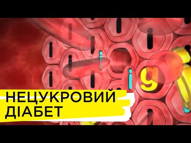 Нецукровий діабет | Рубрика "Запитай у лікаря"