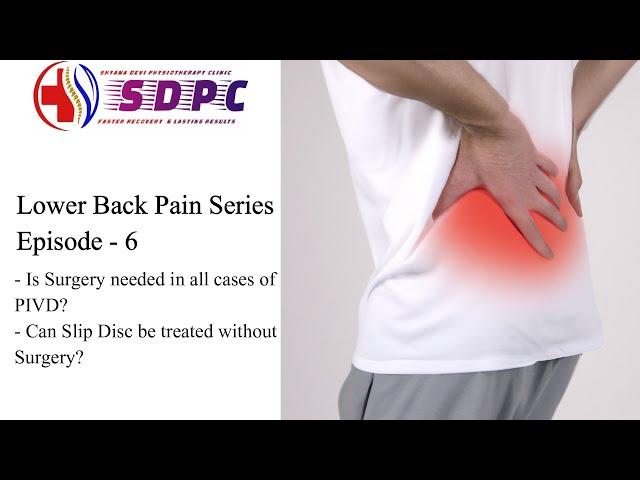 Can PIVD be treated without Surgery? | Lower Back Pain Series | EP:6 #lowerbackpain #physiotherapy