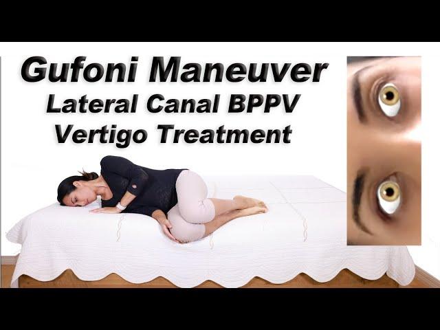 Gufoni Maneuver to Treat BPPV of the Lateral Canal (Ageotropic and Geotropic Variations)