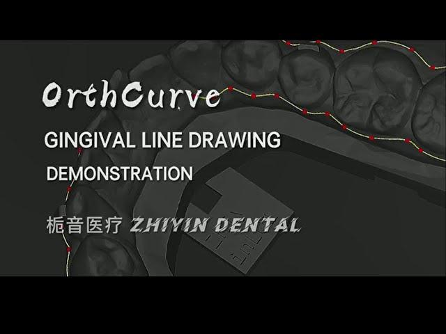 OrthCurve Demonstration