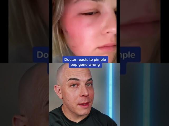 Doctor reacts to the risks of pimple popping! #pimple #pimplepopper #dermreacts