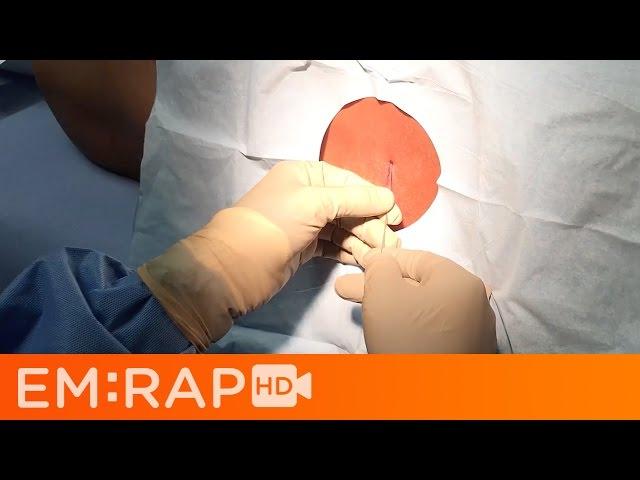 Lumbar Puncture Tutorial