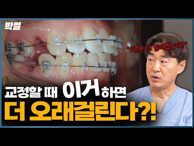 치아교정을 길어지게 하는 원인? #치아교정 #치아교정변화 #치아교정기간