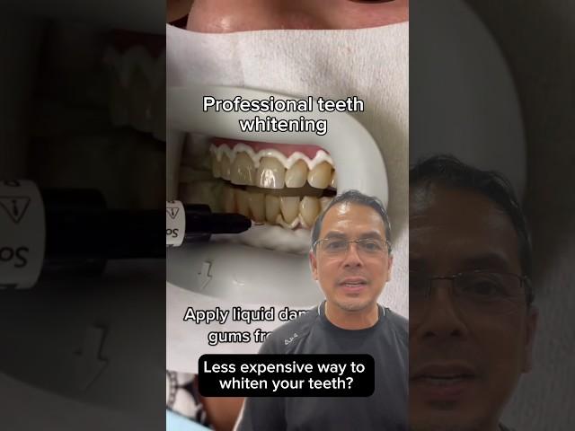 Professional Teeth Whitening vs Hydrogen Peroxide EXPLAINED | In Office to Hands On Dental Training