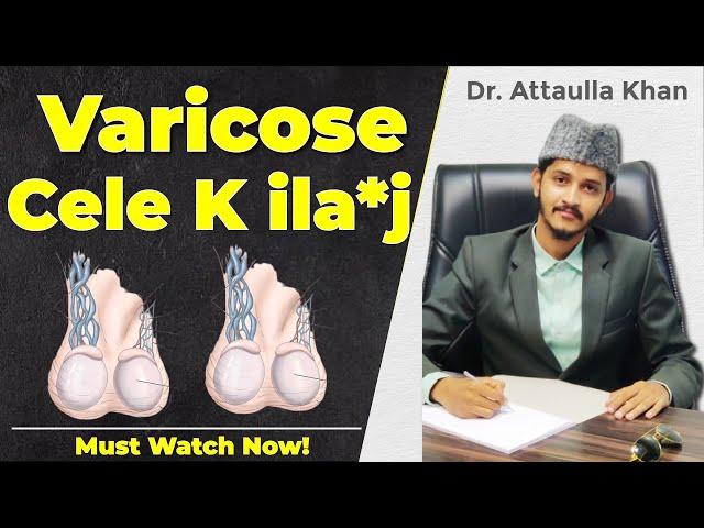 4th stage varicose cele kaise the*ek ho sa*kthe hai? Dr. Attaullah Khan