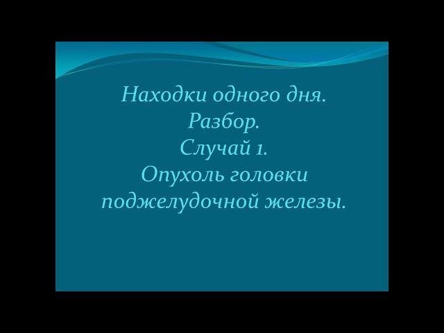 Находки одного дня. Случай 1. Опухоль головки поджелудочной железы.