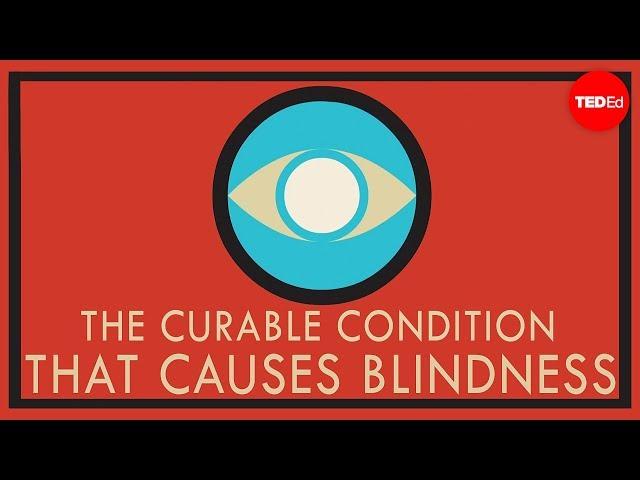 A curable condition that causes blindness - Andrew Bastawrous