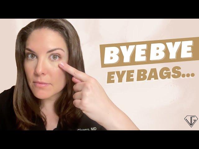 How to QUICKLY Get Rid of Your Eye BAGS For Good