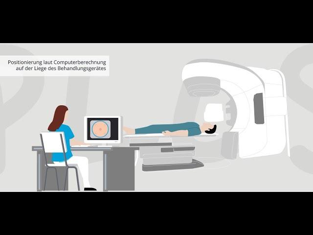 Team Radiologie Plus Erklärvideo STRAHLENTHEAPIE (Teil 2)