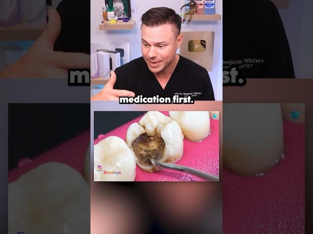 Dentist Reveals What REALLY Happens In A Root Canal! 