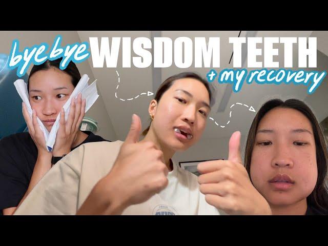 GETTING ALL MY WISDOM TEETH REMOVED *surgery recovery vlog*