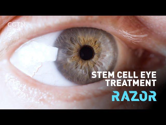 Stem cell eye treatment #RAZOR