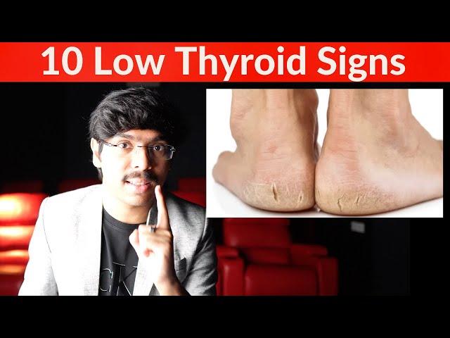 10 Skin Signs of LOW THYROID (Skin Signs of Hypothyroidism) in Telugu! మీ SKIN చెప్పేస్తుంది