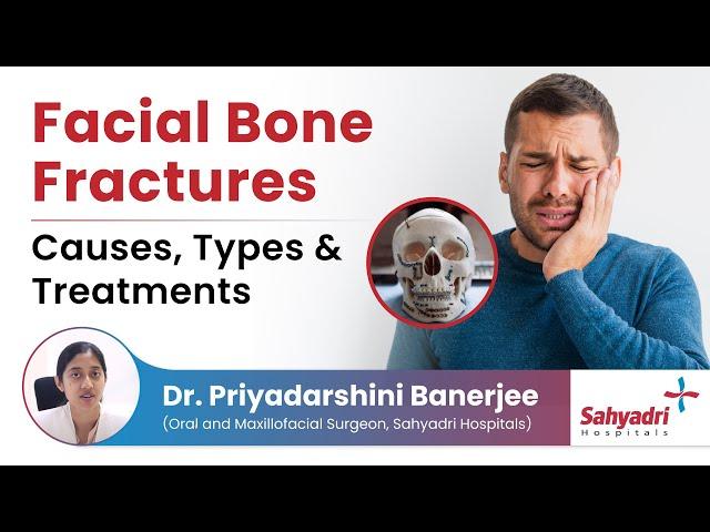 Facial Bone Fractures Causes, Types & Treatments | Facial Fractures | - Dr. Priyadarshini Banarjee