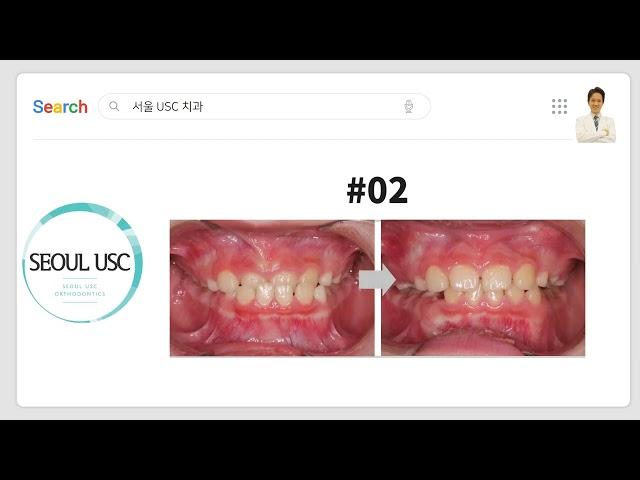 평택 교정전문 치과 서울 USC 치과란 ~?