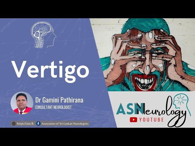 Vertigo by Dr Gamini Pathirana