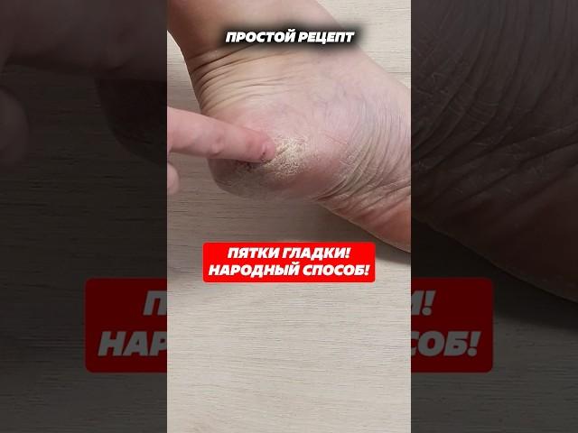Пятки гладки! Народный способ! #пятки #педикюр #уходзакожей #трещинынапятках #грубаякожа #кожа