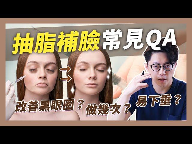 抽脂補臉常見QA 脂肪位移？補太多怎辦？黑眼圈能治療嗎｜周杰醫師