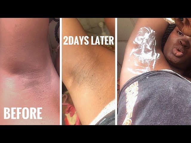 COLGATE TOOTHPASTE AND LEMON LIGHTENS DARK UNDERARM IN JUST 3DAYS