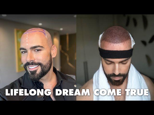 My Emotional Hair Transplant Journey in Istanbul, Turkey with Hairneva