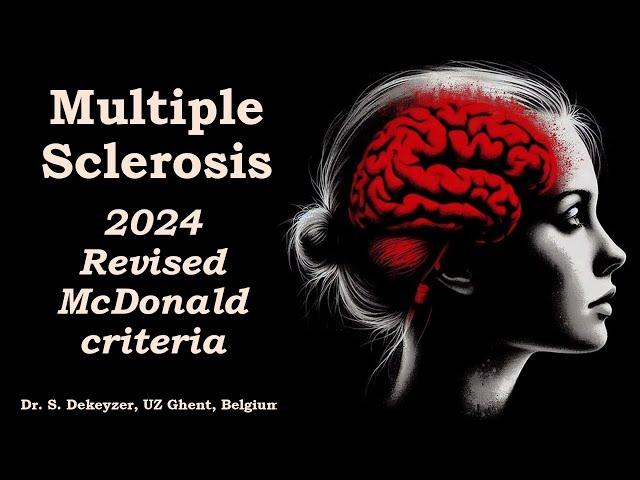 2024 revised McDonald Criteria for Multiple Sclerosis