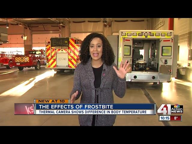 Overland Park Fire Department shares its winter safety tips