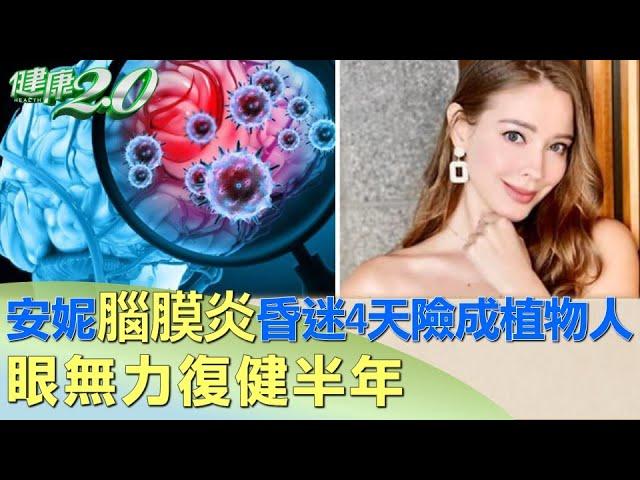 安妮腦膜炎昏迷4天險成植物人 眼無力復健半年 健康2.0