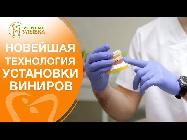 Виниры без обточки.  Преимущества установки виниров без обточки зубов. Здоровая Улыбка. 12+