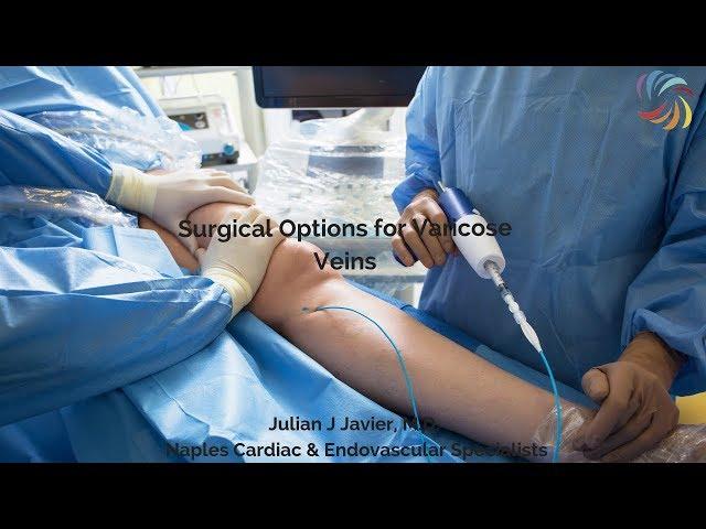 Minimally Invasive & Other Options for Varicose Veins with Dr. Javier