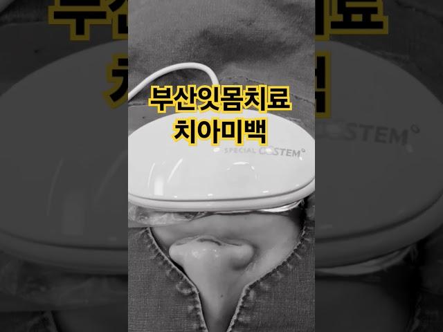 부산잇몸치료 치주과 치과 전문의 치아미백