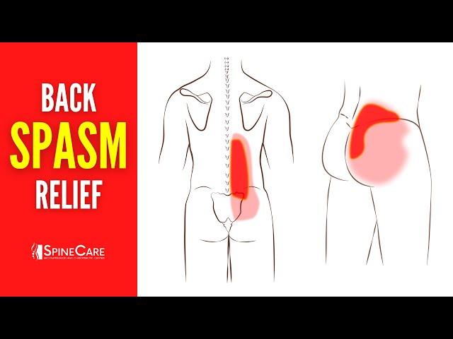 How to Get Rid of Lower Back Spasms and Muscle Knots | INSTANT RELIEF