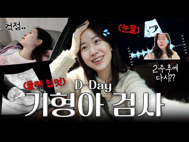 임신 12주 D-day기형아 검사하는 날!! 공포의 입덧 시작 심장소리 듣기까지 산부인과 3번 둘째 임신 브이로그