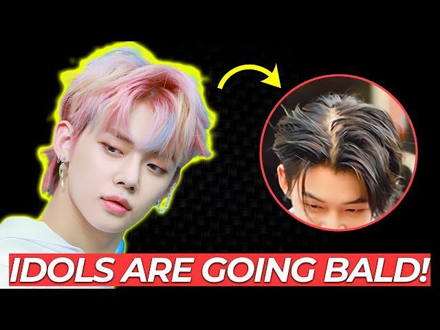 K-Pop Hair Pandemic - K-Pop Idols Are Going Bald