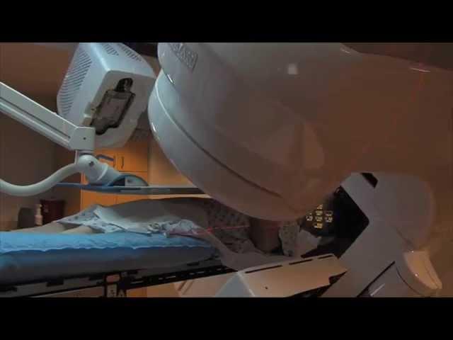 Prostate Cancer Survivor: Willamette Valley Cancer Institutes Calypso Treatment