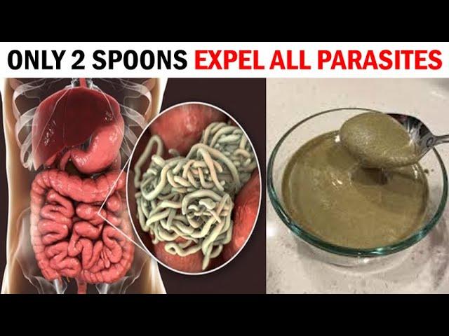 Only 2 Spoons to Completely Expel Worms and Parasites from Your Body!