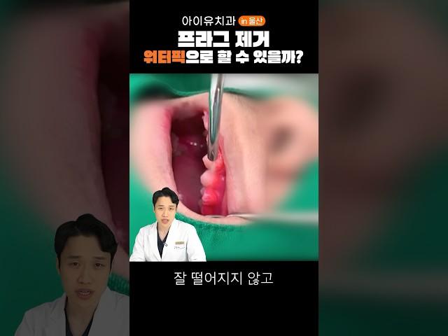 워터픽? 음식물은 빼주는데.. #치아관리