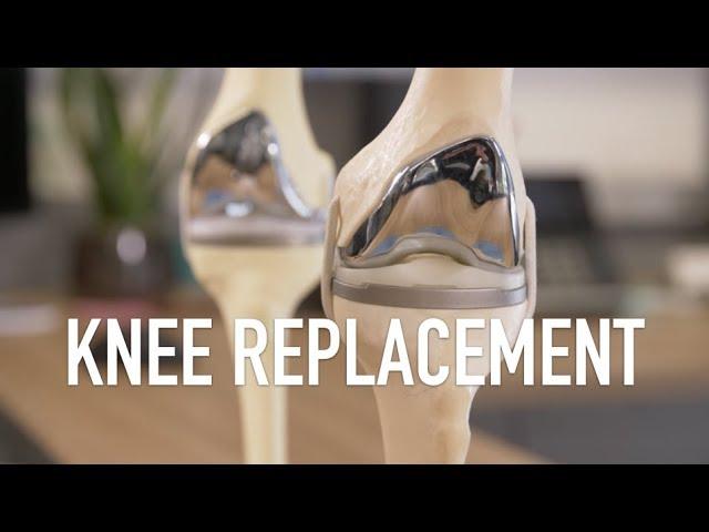 Knee Replacement Surgery and How To Know If It's Right For You