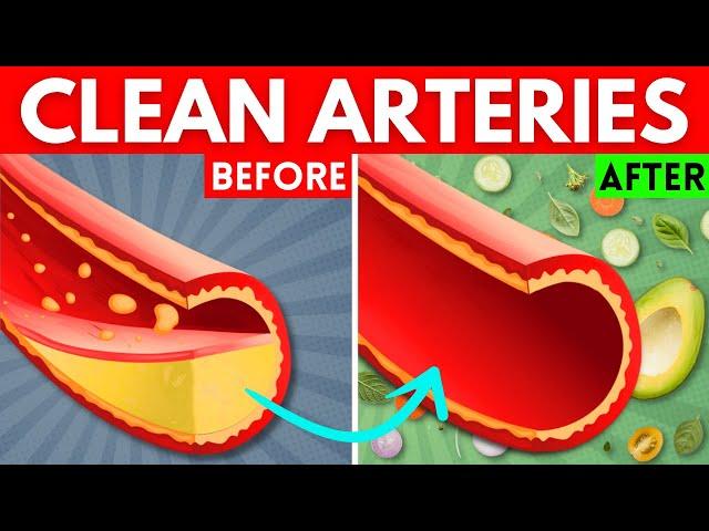 21 Heart Healthy Foods to UNCLOG ARTERIES And Prevent Heart Attacks