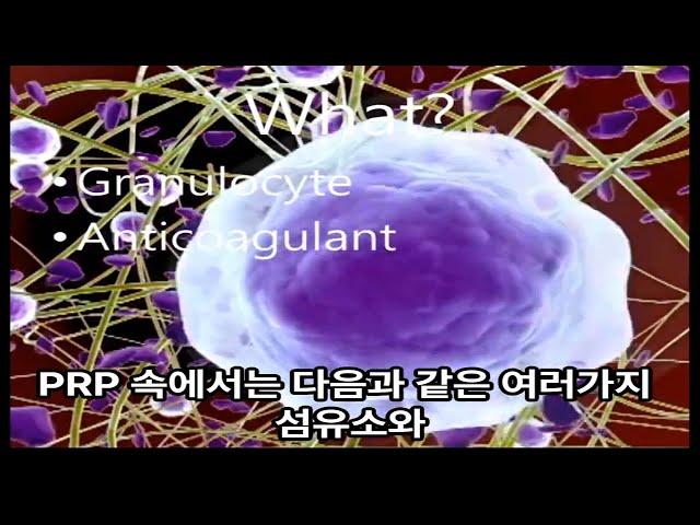 팔꿈치 힘줄 손상의 PRP 치료